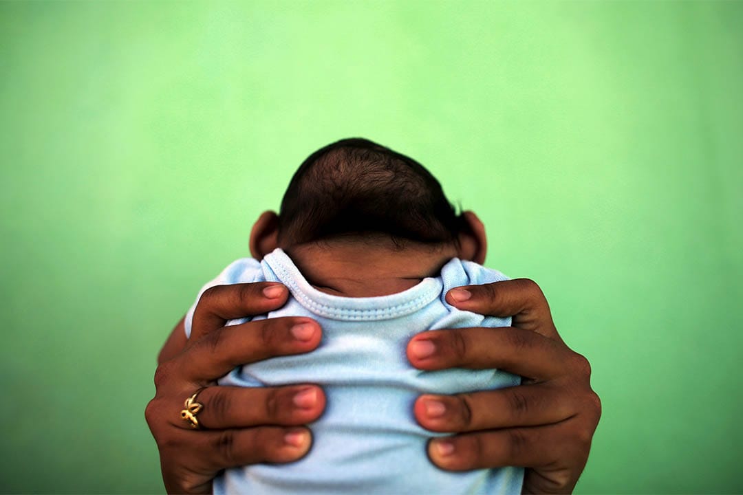 2016年2月11日,巴西,一個母親抱起患有小頭症的孩子。