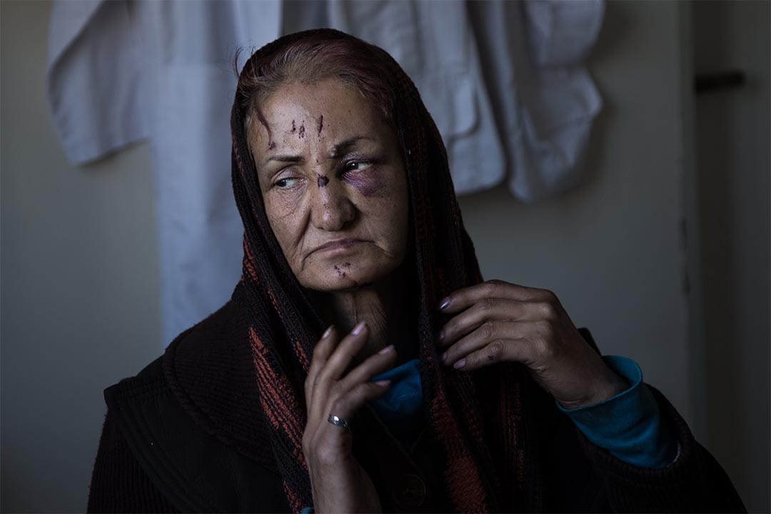 2016年1月，伊朗德黑蘭(Tehran, Iran)，一個女人在德黑蘭哈蘭迪(Harandi)一間無國界醫生診所中整理她的頭巾。這所診所向脆弱的婦孺、吸毒者及其家人、性工作者、阿富汗童工以及吉卜賽社群等提供醫療及心理援助。