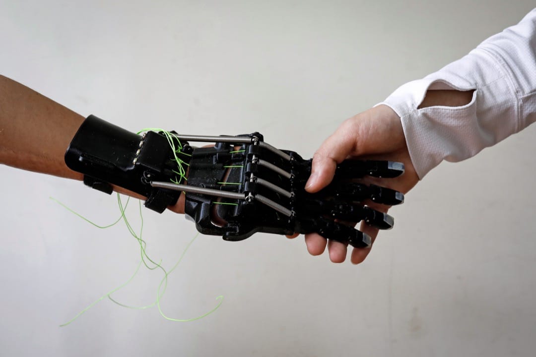 戴上義肢的Angel牽著媽媽的手。