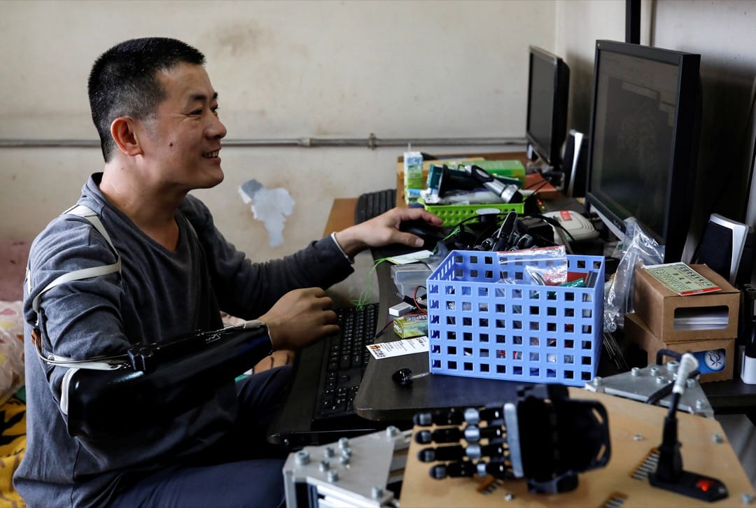 張憲良用電腦設計義肢。