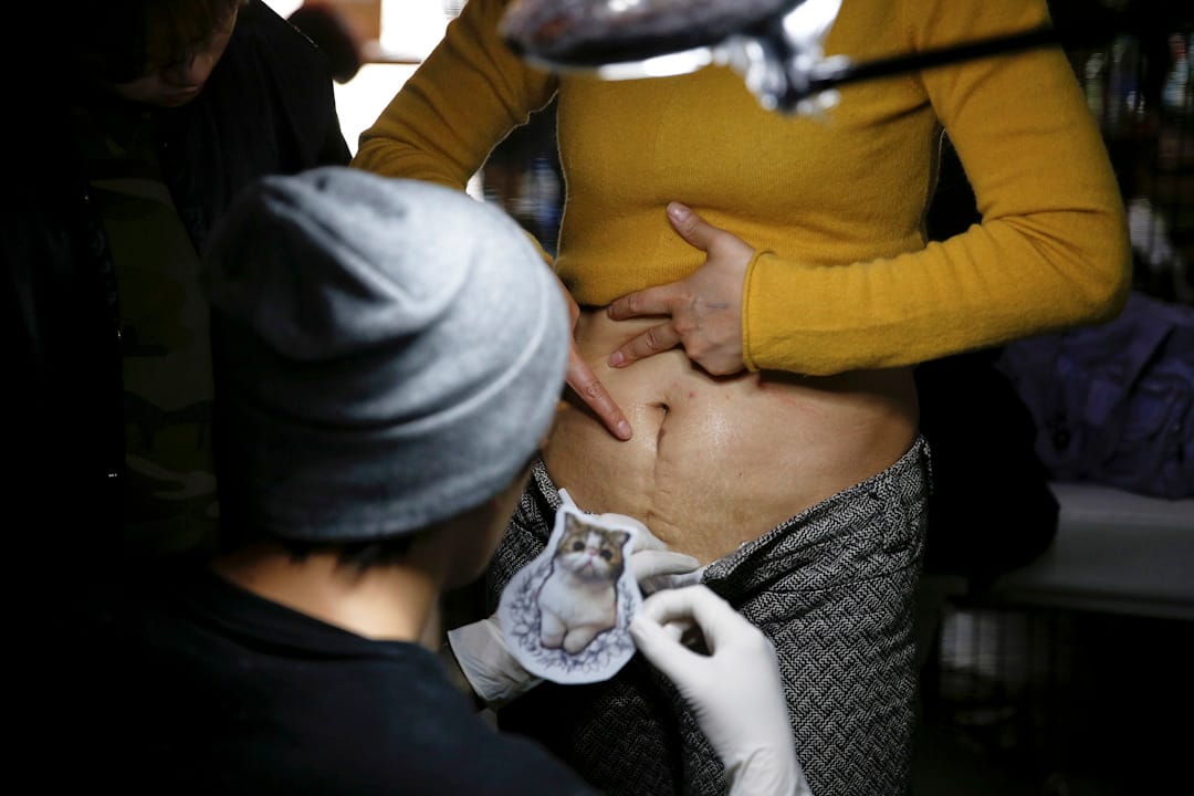 紋身師正準備為 Wang Jing 的疤痕紋上圖案。