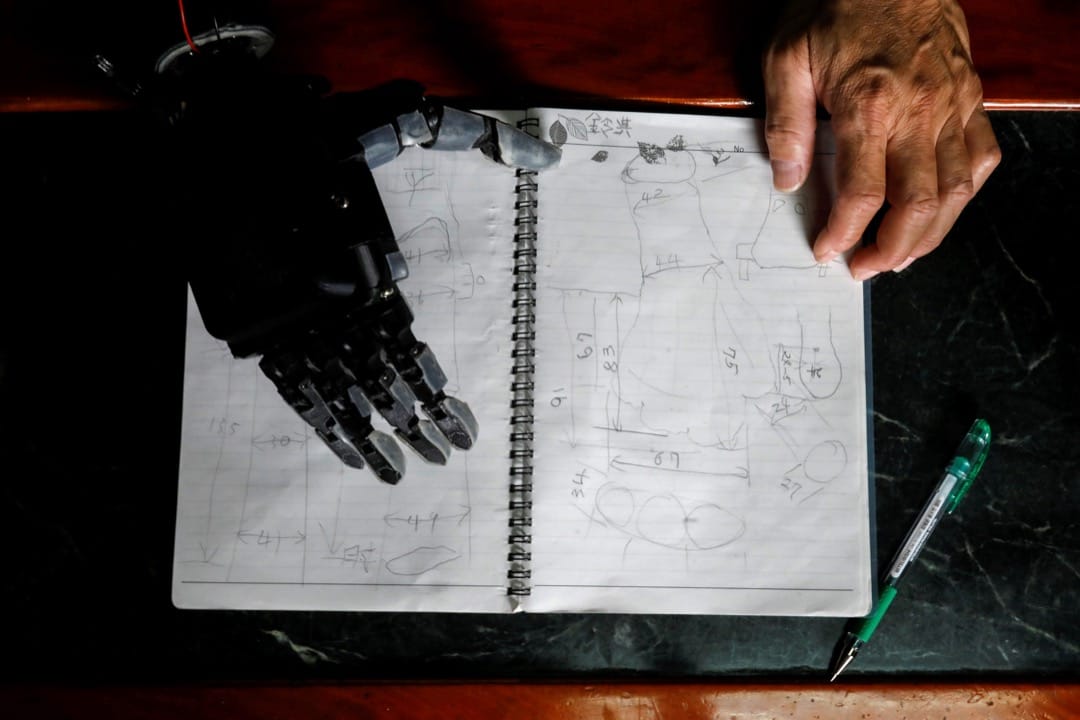 張憲良的筆記記錄了有關Angel需要義肢的右手的情況和資料。