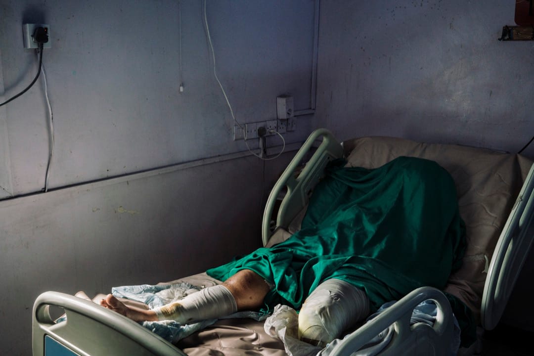 2018年12月13日,也門港口城市荷台達,25歲的Wafa Ahmed Hathim躺在醫院裏,她在一次迫擊砲襲擊中失去了左腳。