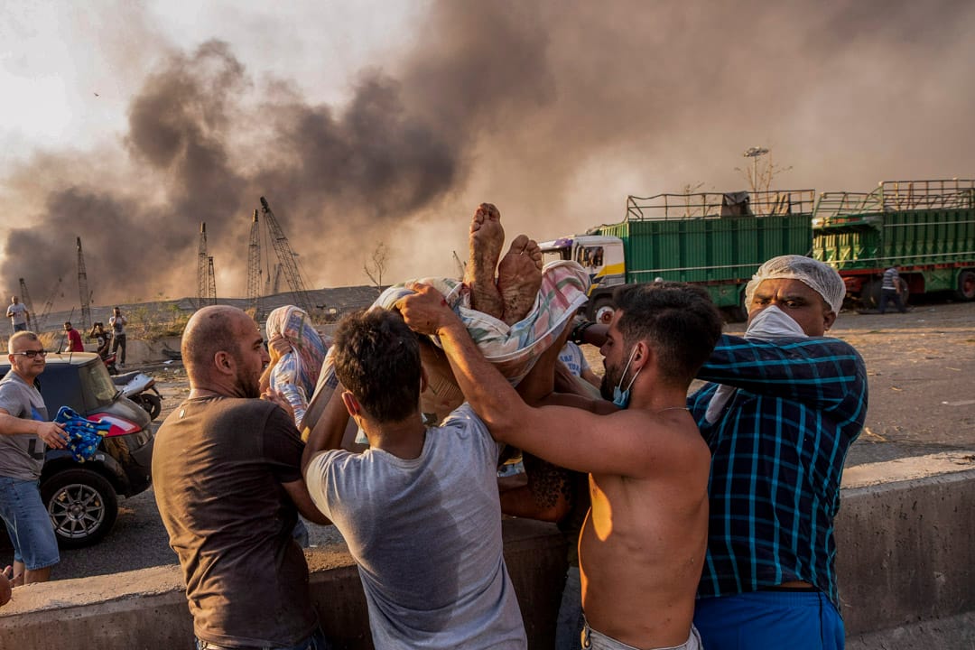 一名在爆炸中受伤的伤者被抬离现场。