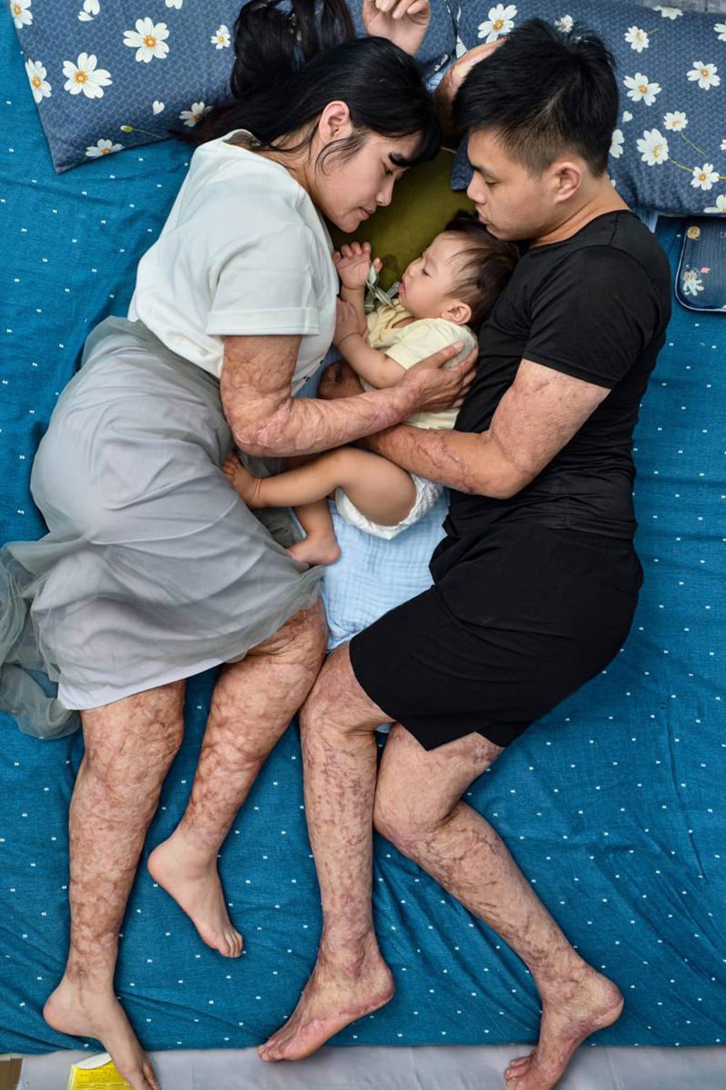 肖像类第二名。睡眠其实是人最接近死亡的状态，对比生与死，浴火与重生，被火焰烧烫伤的夫妻怀中，即将满周岁的儿子正一天天的成长茁壮。经历八仙尘爆生死难关的两个年轻人，复健之路让他们身心煎熬，是彼此互相鼓励让他们决定好好活下去。顺著生命走，意外留下的是，更强的挫折忍耐力。