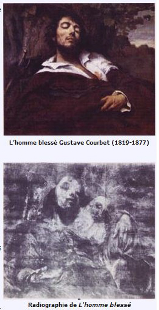 古爾貝的《受傷的男子》（L』Homme blessé，Gustave Courbet）。