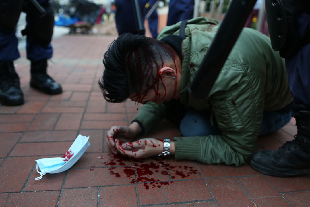 清晨7时，警方在旺角清场期间，一名示威者在山东街近洗衣街被警察使用警棍打至头部流血，倒卧地上，其口罩跌在身旁。摄：卢翊铭/端传媒